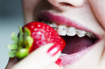 Woman Biting on Strawberry with Braces