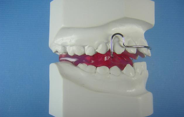 Bionator Ii To Close Accutech Orthodontic Laboratory Products